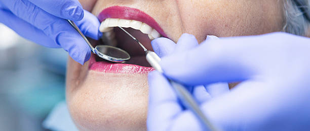 Best Emergency Tooth Extraction in Hollis, OK